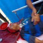Bentrok di Belawan Kambuh, Satu Kritis Diterjang Peluru