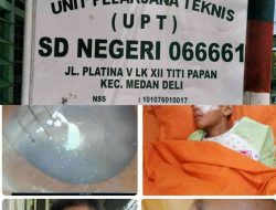 Guru SDN 066661 Diduga Lalai, Mata Murid Kelas 3 Terancam Buta Sebelah