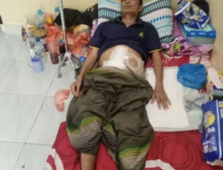 Perjuangan Armei Tambunan Lawan Tumor Ganas Terkendala Ekonomi, Butuh Uluran Tangan